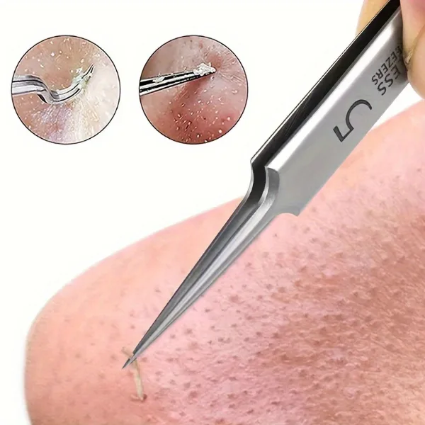 1 Pack Extra Fine No. 5 Cellular Acne Blackhead Tweezers - Facial Beauty Remove Acne Needle Tools for Skin Car
